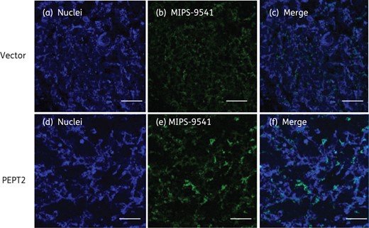 Fluorescence imaging of MIPS-9541 accumulation in HEK293 cells transfected with PEPT2 or the vector alone. MIPS-9541 (10 µM) was applied to HEK293 cells overexpressing PEPT2 or the vector for 5 min at 37°C. Cells were washed with cold PBS (pH 7.4) three times and mounted in SlowFade® Gold Antifade Mountant with DAPI. Panels (a) and (d) show nuclei staining (blue), panels (b) and (e) show MIPS-9541 accumulated in cells (green), panel (c) shows the merged images of panels (a) and (b) and panel (f) shows the merged images of panels (d) and (e). Scale bars = 50 µm.