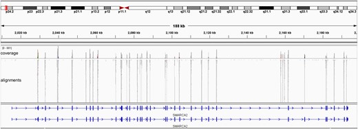 Distribution of sequencing reads in the SMARCA2 region. All targeted exons were covered with sufficient reads. Stitched read data from the samples were illustrated using Integrative Genomics Viewer as an example.