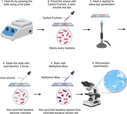 Schematic diagram of the acid-fast staining process and representative results of sputum smears. The procedure involves primary staining with carbol fuchsin, followed by decolorization with acid-alcohol and counterstaining with methylene blue. Acid-fast bacilli (AFB), including MTB, retain the primary stain, while non-acid-fast organisms and background material take up the counterstain. Created with BioRender.com.