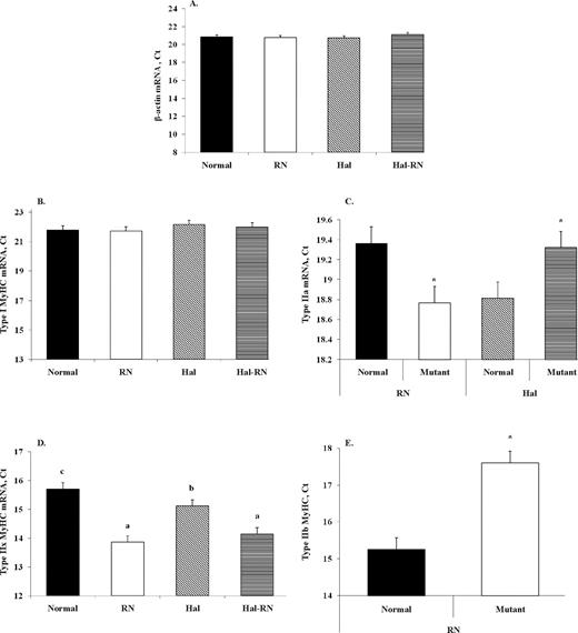Real-time determination of β-actin (A), myosin heavy chain (MyHC) type I (B), IIa (C), IIx (D), and IIb (E) mRNA isoforms of LM from normal, Rendement Napole (RN), Halothane (Hal), and Hal-RN double mutant pigs. *P < 0.05 vs. control. a–cMeans with different letters differ (P < 0.05; n = 10 per group for A, B, and D and n = 20 per group for C and E). Ct = threshold cycle.