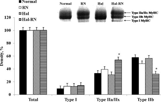 Myosin heavy chain (MyHC) isoform contents in normal, Rendement Napole (RN), Halothane (Hal), and Hal-RN double mutant pigs as determined by SDS-PAGE analysis. Bottom, middle, and top bands contain type I, IIb, and IIa/IIx MyHC, respectively. *P < 0.05 vs. other genotypes within a MyHC isoform (n = 3 per treatment).