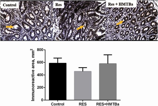 Photomicrography and quantification of immunoreactive area for GHS-R1a (arrows) in the duodenum (simple columnar epithelium) of calves in the Control, RES, and RES + HMTBa groups. Mean ± SEM. Scale bar = 100 µm.