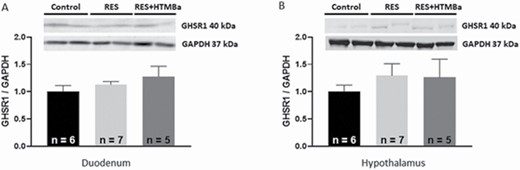 Expression of GHS-R1a in the duodenum (A) and in the hypothalamus (B) of calves in the Control, RES, and RES + HMTBa groups. Mean ± SEM.