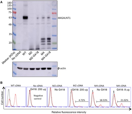 Readthrough of the PTC was induced/increased as full-length proteins of B4GALNT1 and its product GM2 by treatment with aminoglycosides. (A) Immunoblotting of lysates from B78 cells after transfection with B4GALNT1 cDNAs of WT, mutant M4 or M2, and cultured in the presence or absence of G418 (M4: 8 μg/ml and M2: 200 μg/ml) for 48 h after transfection. Cell lysates were applied for SDS-PAGE and then blotted onto a PVDF membrane. After blocking, the membranes were incubated with 1:500 fold-diluted anti-B4GALNT1 antibody, then incubated with HRP-conjugated anti-mouse IgG (1:2000) after washing. Protein bands on the membrane were detected by Amersham Imager 680TM (GE Healthcare Bio-Sciences AB, Tokyo, Japan) using ImmunoStarTM LD (Wako, Osaka, Japan) luminescence reagents. β-actin was examined to confirm equal loading of samples. (B) Flow cytometry was performed using B78 cells transfected with B4GALNT1 cDNAs of WT, mutant M4 or M2, and cultured in the presence or absence of G418 as described in (A). Cells were incubated with the primary antibody, and then stained with FITC-conjugated goat anti-mouse IgG as a secondary antibody after washing. Control cells were prepared with secondary antibody alone. Percent of positive cells in each transfectant was shown.