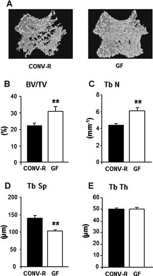 https://doi.org/10.1002/jbmr.1588 social preview image