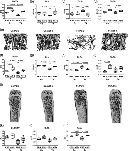 BMP ligand trap ALK3‐fc protects against hyperthyroidism‐induced bone loss in male mice. Twelve‐week‐old male C57BL/6JRj mice remained euthyroid (Co.) or were rendered hyperthyroid (T4) by adding 1.2 μg/mL L‐thyroxine into their drinking water over 4 weeks. Additionally, mice were treated with either 5 mg/kg BW ALK3‐fc (A3Fc) or phosphate‐buffered saline (PBS) as vehicle control. (A–D) Using micro‐CT analysis, (A) bone volume per total volume (BV/TV), (B) trabecular number (Tb.N), (C) trabecular separation (Tb.Sp), and trabecular thickness (Tb.Th) were assessed at the vertebral body L4. (D) Representative 3D reconstructions of the trabecular bone compartment of L4 vertebra of control and treated mice. In addition, (F) BV/TV, (G) Tb.N, (H) Tb.Sp, and (I) Tb.Th were analyzed via micro‐CT measurements at the distal femur. (J) Representative 3D reconstructions of the femora of control and treated mice. Further, cortical bone parameters, (K) cortical bone volume/total volume (Ct.BV/TV), and (L) cortical thickness (Ct.Th) were assessed at the femoral midshaft. (M) Maximal force (Fmax) was determined by 3‐point bending test of femora as an indicator of bone strength. Data are represented as the mean ± SD. n = 4–5 per group. Statistical analysis was performed by two‐way ANOVA. Statistical significance is denoted in the graphs.