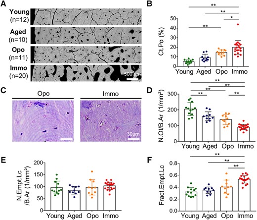 Cortical porosity and osteocyte characteristics. (A) Degree of cortical porosity between young, aged, osteoporotic (Opo), and immobilized (Immo) individuals shown in qBEI images. (B) Substantially increased cortical porosity with immobilization. (C) Histological images of toluidine blue–stained bone sections illustrating reduced number of osteocyte lacunae and predominance of empty lacunae in immobilization compared with the osteoporosis group. (D) Lower number of osteocytes per bone area with immobilization. (E) No significant differences in number of empty lacunae per bone area, but a higher fraction of empty lacunae with immobilization is evident (F). *p < .05, **p < .01.