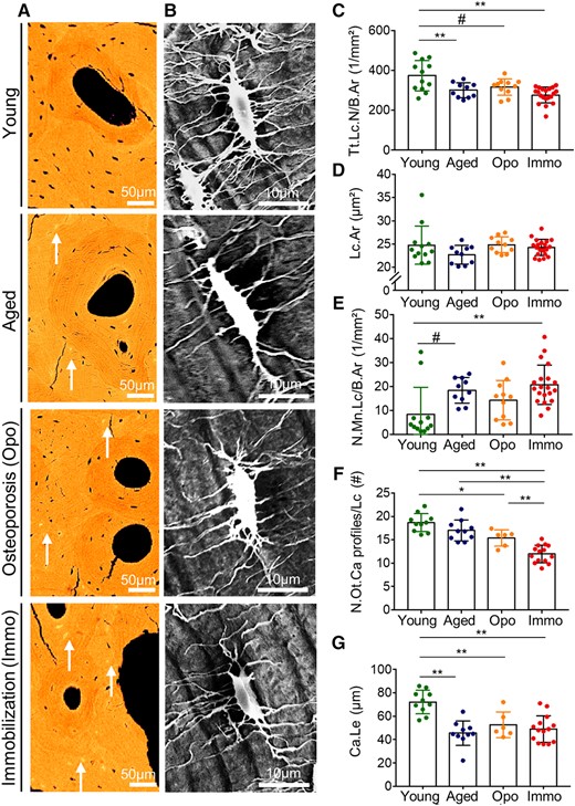 Osteocyte lacunar and canalicular characteristics. (A) Reduction of osteocyte number and size as well as the increase of micropetrotic lacunae (white arrows) are evident in qBEI images from young to immobilization group. (B) Osteocyte lacunae were imaged using acid‐etching and subsequent SEM to quantify the osteocyte canalicular profiles. (C) The total lacunar number decreased significantly between young and immobilized cases. (D) Lacunar area was not different between the groups. (E) The number of mineralized lacunae is the lowest in the young group and then show rising numbers with reaching a maximum in immobilization. (F) The number of osteocyte canalicular profiles per lacuna is high in the young group and then shows a declining rate. The lowest number of canalicular profiles was found in the immobilization cases. (G) Canalicular mean maximum length measured between outermost lacuna to the Haversian canal is highest in the young group. *p < .05, **p < .01, #.05 < p < .1.