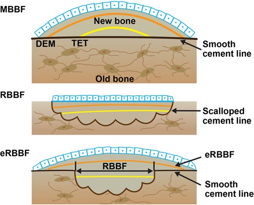 Illustration showing the types of bone formation assessed with quadruple labeling. MBBF = modeling‐based bone formation; RBBF = remodeling‐based bone formation; eRBBF = extended remodeling‐based bone formation; TET = tetracycline (the first set of labels); DEM = demeclocycline (the second set of labels).