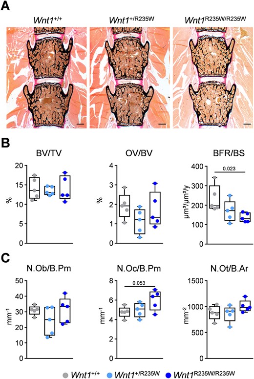 Vertebral body phenotype of 12‐week‐old female Wnt1+/R235W and Wnt1R235W/R235W mice. (A) Representative undecalcified spine sections (vertebral bodies L3 and L4) from mice with the indicated genotypes stained after von Kossa/van Gieson. Scale bar = 500 μm. (B) Histomorphometric evaluation of trabecular bone volume (BV/TV), osteoid volume (OV/BV), and bone formation rate (BFR/BS). (C) Histomorphometric evaluation of osteoblast number (N.Ob./B.Pm), osteoclast number (N.Oc./B.Pm), and osteocyte number (N.Ot./B.Ar). Data were analyzed by one‐way ANOVA with Dunnett's multiple comparison test. The p values are indicated above the horizontal bars up to a value of 0.1.