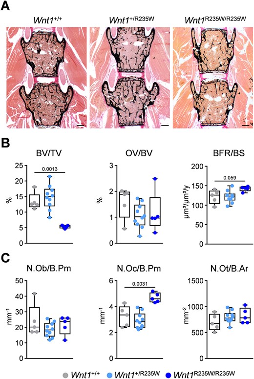Vertebral body phenotype of 52‐week‐old female Wnt1+/R235W and Wnt1R235W/R235W mice. (A) Representative undecalcified spine sections (vertebral bodies L3 and L4) from mice with the indicated genotypes stained after von Kossa/van Gieson. Scale bar = 500 μm. (B) Histomorphometric evaluation of trabecular bone volume (BV/TV), osteoid volume (OV/BV), and bone formation rate (BFR/BS). (C) Histomorphometric evaluation of osteoblast number (N.Ob./B.Pm), osteoclast number (N.Oc./B.Pm), and osteocyte number (N.Ot./B.Ar). Data were analyzed by one‐way ANOVA with Dunnett's multiple comparison test. The p values are indicated above the horizontal bars up to a value of 0.1.