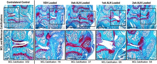 ALN treatment immediately after loading reduced the calcification of the meniscus and MCL at 6 weeks following loading. Representative images (4×, scale bar = 1 mm) of Safranin‐O–stained limbs of different treatment groups at 6 weeks after loading. Squares indicate areas selected for higher magnification photomicrographs in the lower panels (10×, scale bar = 500 μm). The number of calcified MCLs is indicated below each treatment group. The relative number of limbs with calcifications present was altered with inhibition of bone remodeling after loading (p = 0.010, Fischer's exact test), but no paired treatment comparisons were significant. Abbreviations: ALN, alendronate; MCL, medial collateral ligament; VEH, vehicle.