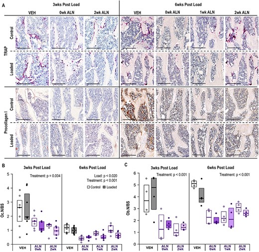 ALN treatment reduced bone remodeling. (A) Representative photomicrographs of TRAP (osteoclasts) and anti‐procollagen I (active osteoblasts) stained bone tissues in the metaphysis at 3 and 6 weeks following a single bout of loading. Scale bar for TRAP and Procollagen I = 200 μm. (B) ALN treatment decreased presence of osteoclasts at both 3 weeks (p = 0.004) and 6 weeks (p < 0.001). Loading also decreased osteoclasts at 6 weeks (p = 0.020). (C) ALN treatment decreased presence of active osteoblasts. Statistical test: linear mixed‐effects model. Box plot indicates median and interquartile range. Individual datum points (n = 7–8/group for TRAP, n = 4/group for Procollagen I) are overlaid. Abbreviations: ALN, alendronate; TRAP, tartrate‐resistant acid phosphatase; VEH, vehicle.