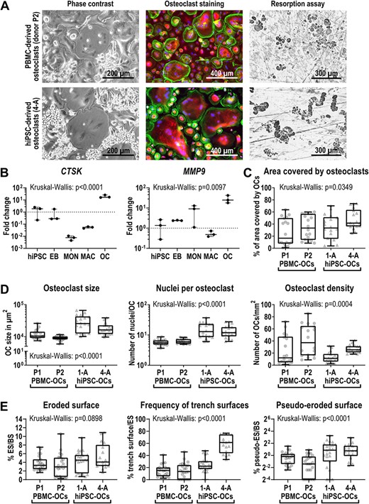 Characterization of differentiated hiPSC‐derived osteoclasts. Osteoclasts were differentiated from PBMCs (donors P1 and P2) and the two hiPSC lines BIHi001‐A (1‐A) and BIHi004‐A (4‐A). (A) Representative images of osteoclasts in culture (phase contrast), stained osteoclasts (Phalloidin in green, TRAcP in red, DAPI in blue) and osteoclast‐mediated resorption shown as black‐stained cavities on dentine. (B) Expression of osteoclast markers CTSK and MMP9 determined by qRT‐PCR analysis in BIHi004‐A hiPSC‐derived cells in undifferentiated hiPSCs, 4‐day‐old EBs, MONs, MACs, and OCs. Expression is normalized to hiPSCs, GAPDH expression was used as housekeeping control. Shown are data of three independent experiments. For statistical analysis, Kruskal‐Wallis test and Dunn's multiple comparisons were used (Table S3). (C,D) Quantitative analysis of osteoclast morphology parameters. Shown are pooled data from three independent experiments. For statistical analysis, Kruskal‐Wallis test and Dunn's multiple comparisons were used (Table S6). (C) Percentage of area covered by osteoclasts of total well area. (D) Osteoclast size in μm2 (left), number of nuclei per osteoclast (middle) and osteoclast density (right). (E) Analysis of the resorption pattern on cortical bone slices. Percentage of the ES to the BS (left), percentage of the trench surface to the total eroded surface (middle), and percentage of the pseudo‐eroded surface to the total bone surface (right). Shown are pooled data of individual bone slices used in three independent differentiation experiments of each cell line (donor P1 and 1‐A n = 23, donor P2 n = 25, 4‐A n = 17). Significance was calculated using Kruskal‐Wallis and Dunn's multiple comparisons test (Table S8). Box‐plots shown in B–E are plotted with median, interquartile range, maximum, and minimum values and all data points. Abbreviations: BS, total bone surface; DAPI, 4′,6‐diamidino‐2‐phenylindole; EB, embryoid body; ES, eroded bone surface; GAPDH, glyceraldehyde‐3‐phosphate dehydrogenase; hiPSC, human induced pluripotent stem cell; MAC, macrophage, MCFC, myeloid‐cell‐forming complex; MON, monocyte‐like cell; OC, osteoclast; PBMC, peripheral blood mononuclear cell; qRT‐PCR, quantitative reverse transcription polymerase chain reaction; TRAcP, tartrate resistant acid phosphatase.