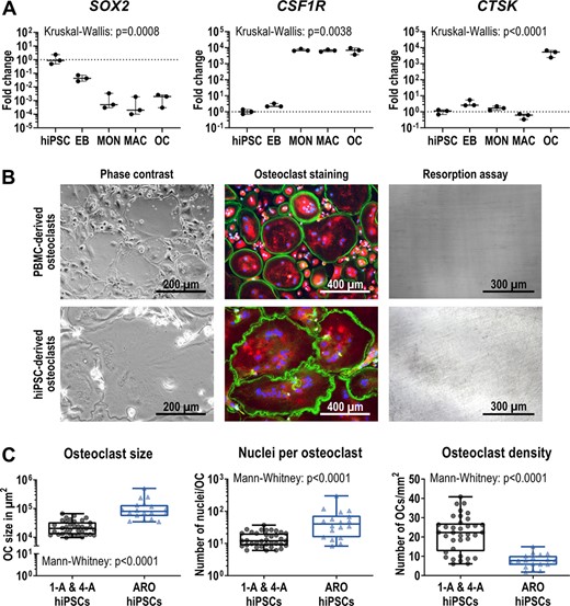Characterization of osteoclasts differentiated from ARO hiPSCs. (A) Expression of pluripotency marker SOX2, monocytic marker CSF1R and osteoclast marker CTSK determined by qRT‐PCR analysis in ARO hiPSC‐derived cells in undifferentiated hiPSCs, 4‐day‐old EBs, MONs, MACs, and OCs. Expression is normalized to hiPSCs, GAPDH expression was used as housekeeping control. Shown are data of three independent experiments. For statistical analysis, Kruskal‐Wallis test and Dunn's multiple comparisons were used (Table S10). (B) Representative images showing osteoclasts in culture (phase contrast), stained osteoclasts (Phalloidin in green, TRAcP in red, DAPI in blue) and lack of osteoclast‐mediated resorption (resorption assay shows no black stained resorption cavities on dentine, see Figure 3A for comparison). Osteoclasts were differentiated from ARO patient‐derived PBMCs and BIHi002‐A ARO hiPSCs. (C) Osteoclasts differentiated from BIHi001‐A (1‐A), BIHi004‐A (4‐A), and ARO hiPSCs quantified according to their size in μm2 (left), the number of nuclei per osteoclast (middle), and the osteoclast density (right). Shown are pooled data of three independent differentiation experiments of each cell line (control hiPSCs 1‐A and 4‐A n = 36, ARO hiPSCs n = 18). Significance was calculated using Mann‐Whitney test. Box‐plots shown in A and C are plotted with median, interquartile range, maximum, and minimum values and all data points. Abbreviations: ARO, autosomal recessive osteopetrosis; DAPI, 4′,6‐diamidino‐2‐phenylindole; EB, embryoid body; hiPSC, human induced pluripotent stem cell; MAC, macrophage; MON, monocyte‐like cell; PBMC, peripheral blood mononuclear cell; OC, osteoclast; qRT‐PCR, quantitative reverse transcription polymerase chain reaction; TRAcP, tartrate resistant acid phosphatase.