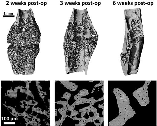 Three dimensional rendering of representative calluses (scans at 7 μm voxel size) for each time point (top). Representative details of the callus struts from the transverse plane (scans at 1.2 μm voxel size) at the three post op time points; acquired in the white rectangular area on the top images (bottom). post op = postoperation.