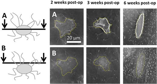 Illustrative images of canaliculi in the calluses at the three different time points. The yellow area delimits the lacunar contour (ROI). (A) Microscopy sections cutting through the center of the lacunae. (B) Confocal planes placed a few micrometers above the lacunae. post op = postoperation; ROI = region of interest.