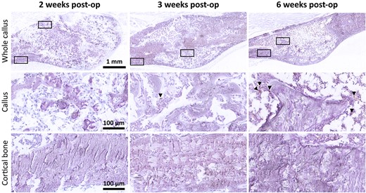 TUNEL staining of fracture calluses (top row) with 40× magnified regions below (boxed) corresponding to the callus tissue (middle row) and periosteal cortical bone adjacent to the callus (bottom row). TUNEL staining (brown), hematoxylin counterstain (purple). post op = postoperation; TUNEL = terminal deoxynucleotidyl transferase–mediated deoxyuridine triphosphate biotin nick end labeling.
