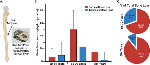 A key rationale for assessing ulnar flexural rigidity at the mid-point of the ulna, where the Cortical Bone Mechanics Technology (CBMT) probe is positioned, is that the ulna consists of predominately cortical bone (A) at this location. This is important because, as illustrated in (B) and (C), after ~65 yr of age most bone loss is cortical, and this cortical bone loss is associated with increased incidence of fragility fractures.45 Images (B) and (C) were recreated from data in Zebaze et al.45, Lancet 2010. The figure was created using BioRender.