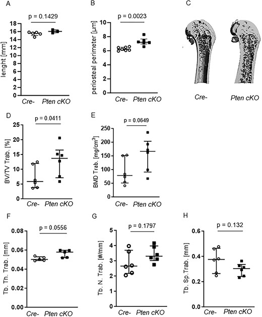 Pten cKO in osteoprogenitor cells results in changes in trabecular bone architecture. (A) Femur length did not differ between Cre-negative (Cre-) and Pten cKO mice, while (B) periosteal perimeter was significantly increased in Pten cKO femora (P = .0023, n = 7 Cre-, n = 6 Pten cKO). The trabecular part of femora was assessed using μCT. (C) A representative image of μCT 3D reconstruction of the distal trabecular femur of Cre- and Pten cKO mice. (D) BV/TV (P = .0411, n = 6 per group) and (E) BMD (P = .0649, n = 6 per group) were increased in Pten cKO bones. (F) Femoral trabecular thickness (Tb.Th) was higher in Pten cKO femora (P = .0556, n = 6 per group), with a trend toward (G) higher trabecular number (P = .1797) and (H) less separation (P = .132).