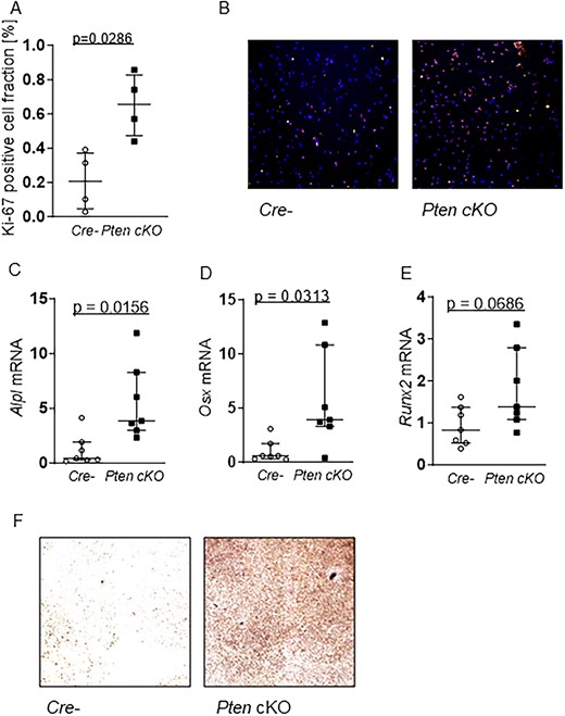 Pten cKO enhances proliferation and capacity for osteogenesis in BMSCs. (A) Proliferation marker Ki-67 immunofluorescence staining (Ki67/Hoechst = proliferative fraction in %) in Cre-negative (Cre-) and Pten cKO BMSCs at day 1 of proliferation: Pten cKO cells show an increase in the fraction of Ki-67–positive cells (n = 4, P = .0286). (B) Representative images of Ki-67 (red) and Hoechst (blue) staining of Cre- (left) and Pten cKO (right) BMSCs (100× magnification). Cre- or Pten cKO BMSCs (n = 7 per group) were differentiated for 14 days in osteogenic differentiation medium. Expression of osteogenesis markers (C) Alpl (P = .0156), (D) Osx (P = .0313), and (E) Runx2 (P = .0686), determined using qPCR, was increased at mRNA level in Pten cKO BMSCS. (F) Alkaline phosphatase activity was visualized by hydrolysis of p-nitrophenylphosphate staining. Representative images of n = 4 independent experiments (40× magnification). Data are presented as median with interquartile range.