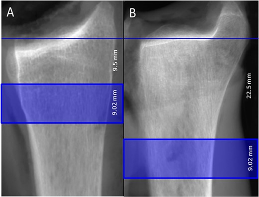 Standard scanning region (highlighted) for HR-pQCT at the distal radius (A) and tibia (B).