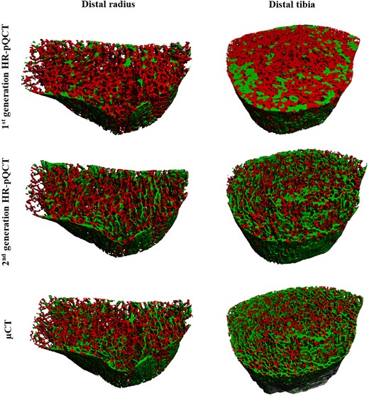 Plate and rod decomposition are shown in green and red in the distal radius and tibia in HR-pQCT images at 82 and 60.7 μm and μCT images at 37 μm.