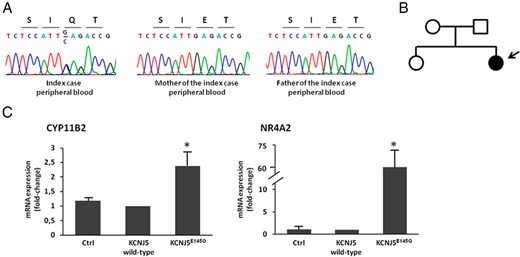 A, Sequencing of peripheral blood DNA showing the KCNJ5 c.433G>C substitution resulting in the p.Glu145Gln (p.E145Q) mutation in the index case, but not in the parents. B, Pedigree of kindred with germline KCNJ5 mutation; affected individual is shown as filled symbol. C, CYP11B2 and NR4A2 gene expression study in HAC15 adrenocortical cells overexpressing empty expression vectror (Ctrl) or human wild-type (WT) KCNJ5 (KCNJ5 WT) or KCNJ5 cDNA encoding the p.Glu145Gln substitution (KCNJ5E145Q). Gene expression levels were quantified by TaqMan real-time PCR using glyceraldehyde-3-phosphate dehydrogenase (GAPDH) as endogenous control. Each bar represents the mean ± SD of relative fold change (over KCNJ5 WT) of gene expression in four independent experiments. Each assay was performed in triplicate.*, P < .05 compared with KCNJ5 WT. CYP11B2 = cytochrome P450, family 11, subfamily B, polypeptide 2; NR4A2, nuclear receptor subfamily 4, group A, member 2.