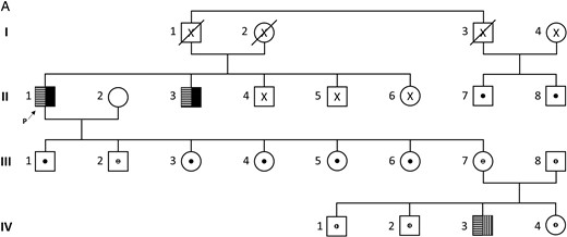Pedigree of an informative family.