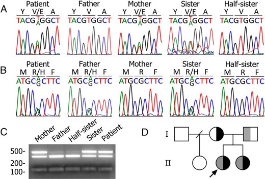 Identification of the compound heterozygous NIS mutation R124H/V270E.