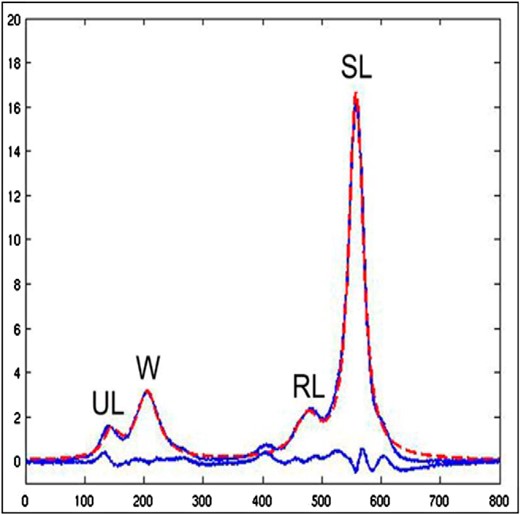 Bone marrow fat evaluation in patients: MRI with spectroscopy.