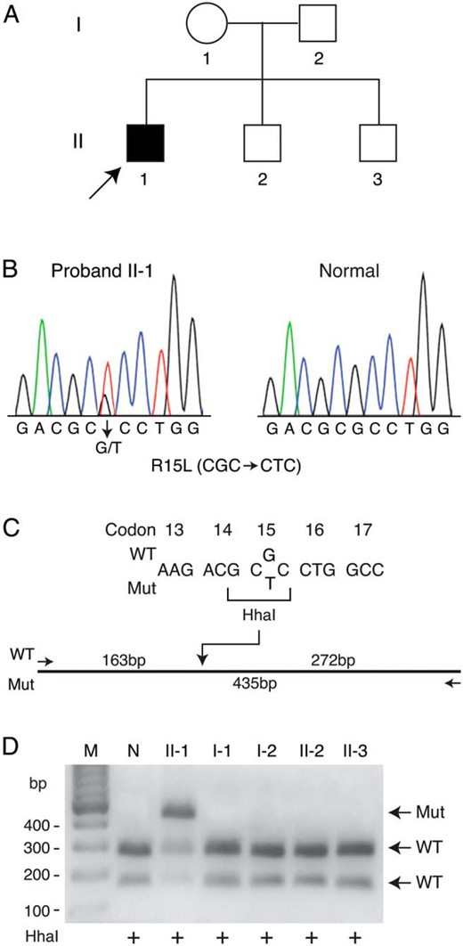 Detection of a mutation in the AP2S1 gene.