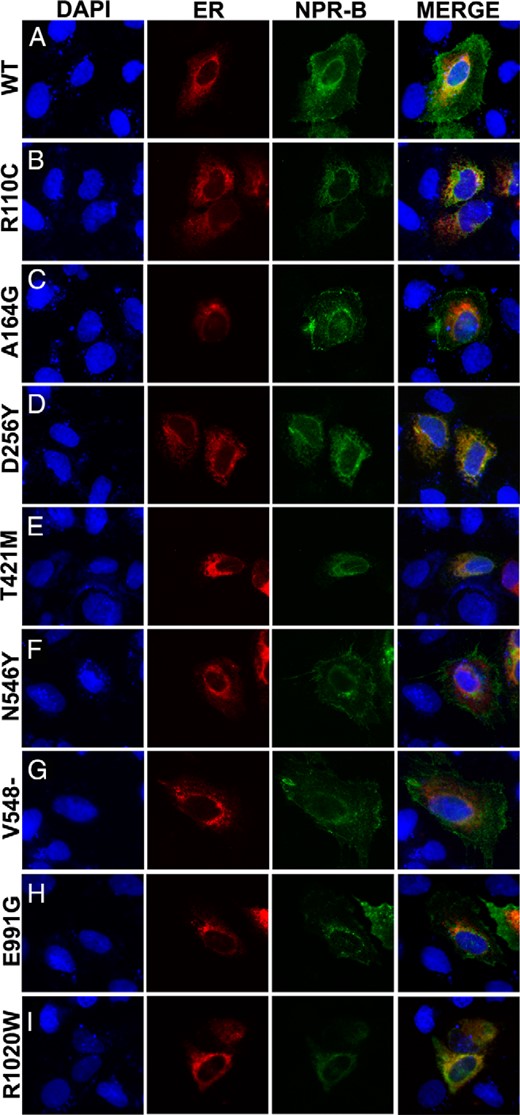 Intracelullar localization of the NPR-B mutants.