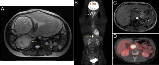 Selected imaging of our case series patients.