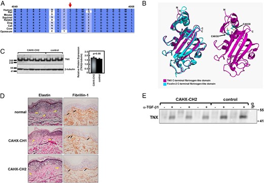 Effects of C4058W in the TNX fibrinogen-like domain.