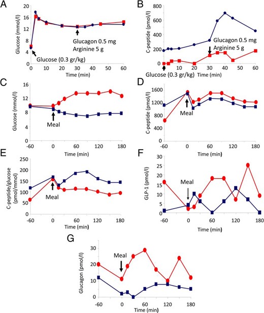 Treatment of a T2-WFS patient with GLP-1-RA. A–F, Improved postmeal hyperglycemia and markedly increased insulin response to stimulation after treatment with GLP-1-RA. A and B, C-peptide response to glucose, arginine, and glucagon. The patient was treated with exenatide for 9 weeks, and C-peptide secretion was assessed by IVGTT (0.3 g/kg), followed by injection of arginine (5 g) and glucagon (0.5 mg) at 30 minutes, before (red) and after (blue) intervention. A, Glucose concentrations; B, plasma C-peptide levels. C–G, C-peptide, GLP-1, and glucagon secretion in response to a standard mixed meal. Mixed meal test was performed without (red) or with injection of 10 μg exenatide 1 hour before meal ingestion (blue).