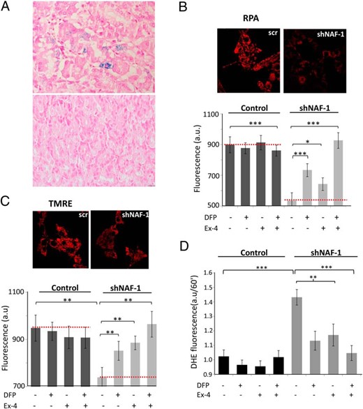 A, Iron deposition in T2-WFS in vivo. B–D, Treatment with exenatide (Ex-4) and the iron chelator DFP reverses mitochondrial iron accumulation, mitochondrial dysfunction, and oxidative stress induced by shRNA knockdown of NAF-1 in INS-1E β-cells. A, Gastric sections of control patients undergoing sleeve gastrectomy (lower panel) and of the T2-WFS patient (upper panel) stained for iron with Prussian blue. Representative images are shown. Magnification, ×400. B–D, shNAF-1 and control β-cells were treated for 48 hours with or without Ex-4 (100 nmol/L) and/or the iron chelator DFP (25 μmol/L). B, Mitochondrial iron accumulation assessed by RPA fluorescence. Semiconfocal microscopy images (left) and bar graph quantifications shown as percentage of mitochondrial iron reduction (right), or as arbitrary units (a.u.) at bottom; scr, scrambled. C, Mitochondrial membrane potential assessed by TMRE fluorescence. Semiconfocal microscopy images (left), and bar graph quantifications shown as percentage of recovery (mitochondrial membrane potential) (right), or as arbitrary units (a.u.) (bottom). D, Bar graph showing quantification of dihydroethidium mean fluorescence at 60 minutes. Ex-4, exenatide. *, P < .05; **, P < .01; ***, P < .001, compared to controls (scrINS-1E and shNAF-1 INS-1 cells) or between the indicated groups.