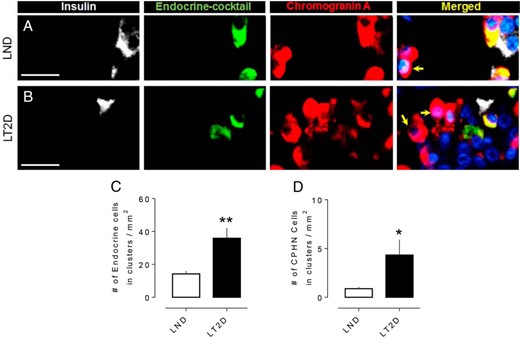 Examples of CPHN cells in pancreas from an LND (A) and an LT2D subject (B). Individual layers stained for insulin (white), endocrine cocktail (glucagon, somatostatin, pancreatic polypeptide and ghrelin) (green), chromogranin A (red), and DAPI (blue) are shown along with the merged (yellow) image. Arrows indicate CPHN cells. (C) The number of endocrine cells (both hormoneexpressing and nonhormoneexpressing) present in scattered clusters of endocrine cells is increased in LT2D. (D) The number of CPHN cells present in scattered clusters of endocrine cells is increased in LT2D. Scale bars, 50 μm (for A and B). (C and D) Data were presented as mean ± SEM, n = 10 per group; *P < .05; **P < .01.