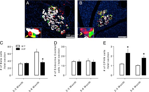 The number of hormone- or nonhormone-expressing endocrine cells in islets of WT and human HIP rats. Examples of CPHN cells in pancreas of 2- to 3-month (A) and 5- to 6-month (B) old HIP rat. Merged images of islet cells stained with insulin (white), endocrine cocktail (glucagon, somatostatin, pancreatic polypeptide, and ghrelin) (green), chromogranin A (red), and merged (yellow). Insets, higher magnification of endocrine cells where CPHN cells are indicated by arrows. (C) The number of insulin expressing beta cells was decreased in early onset diabetic (5–6 month old HIP rats) but not in nondiabetic (2- to 3-month-old HIP rats) compared to WT rats. (D) There was no change in the number of islet hormone expressing endocrine cells other than insulin in either 2–3 month or the 5–6 month in HIP rats compared to WT rats. (E) The number of CPHN cells is increased in both 2- to 3-month and 5- to 6-month-old HIP rats compared to WT rats. C, D, E: white bars: WT rats; black bars: HIP rats. All data were expressed as mean ± SEM, n = 4 per group, *P < .05.