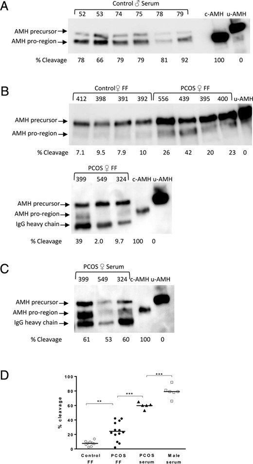 Characterization of AMH in male and female body fluids. Biochemical analysis of AMH in male serum samples (A), control and PCOS FF samples (B), and PCOS serum samples (C) was performed as described in Figure 1B. Representative Western blots are shown. c-AMH or u-AMH (100% uncleaved AMH with a mutated cleavage site) were run as controls to allow identification of the N-terminal proregion and AMH precursor bands. The band that runs just below the N-terminal proregion band in some of the Western blots with a molecular mass of approximately 50 kDa is the human IgG heavy chain, which is detected by the secondary antirabbit Fc Ab. Patient numbers are indicated in the top of the panels. Fifty microliters of male serum samples 52 and 53, 100 μL of samples 74 and 75, and 200 μL of samples 78 and 79 were analyzed in panel A and 400 μL of FF and female serum samples were analyzed in panels B and C. The following volumes of protein eluted from the Ab-Sepharose resin were analyzed by SDS-PAGE: 10 μL of male serum or control FF; 8 μL of PCOS serum; and 5 μL of PCOS FF. D, Comparison of the AMH cleavage levels in male and female body fluids. Mean values are shown for each group. Comparisons were made with proregion/(proregion + precursor) ratios using an ANOVA followed by Tukey’s multiple comparisons test. **, P < .001.