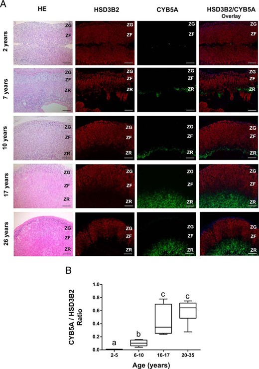 Immunolocalization of HSD3B2 and CYB5A in the human adrenal. A, Representative images of double immunofluorescence of HSD3B2 (red) and CYB5A (green) in adrenal glands from following age groups: 2–5 y (2 y male), 6–10 y (7 and 10 y males), 16–17 y (17 y female) and 20–35 y (26 y female). HSD3B2 and CYB5A are sharply segregated to the zona glomerulosa–ZF and the ZR, respectively. Nuclei are counterstained in DAPI (blue). Scale bars, 200 μm. B, Dual immunofluorescence was performed for HSD3B2 and CYB5A in the adrenal glands of the following age groups: 2–5 y (n = 4), 6–10 y (n = 6), 16–17 y (n = 6), and 20–35 y (n = 6). The areas expressing CYB5A (green) and HSD3B2 (red) were quantified using image analysis, and ratios of areas with CYB5A expression/HSD3B2 expression were then calculated and compared in different age groups. Data are represented as mean ± SEM. Statistical significance was determined using a one-way ANOVA followed by a Holm-Sidak test. Different letters above the bars indicate statistically significant differences (P < .05) between the different age groups.