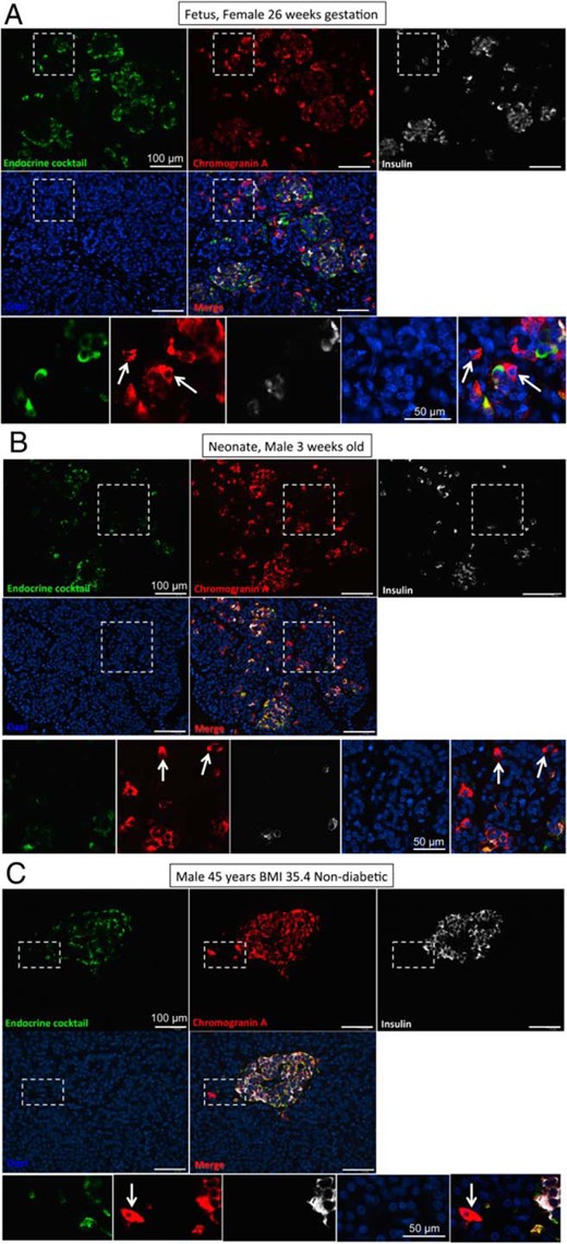 Representative images taken at low power (×10 objective) to show pancreas from a fetus at 26 weeks' gestation (A), a neonate 3 weeks after delivery (B), and a 45-year-old nondiabetic adult with a BMI of 35.4 kg/m2 (C).