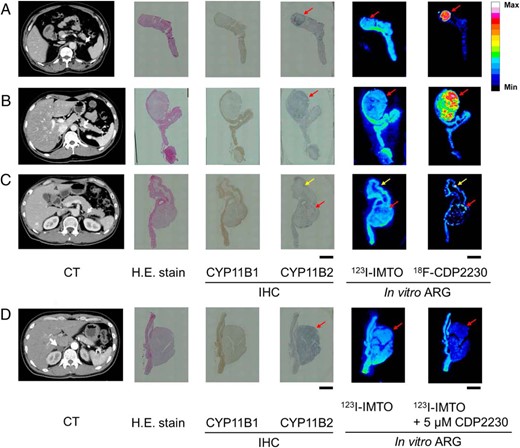 In vitro ARG of 123I-IMTO and 18F-CDP2230 using human APA tissue.