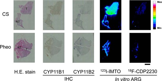In vitro ARG of 123I-IMTO and 18F-CDP2230 using human adrenal tissue derived from CS and Pheo.