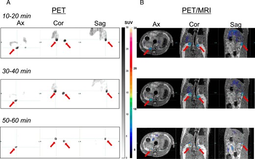 PET (A) and PET/MRI (B) images obtained using 18F-CDP2230 in rats.