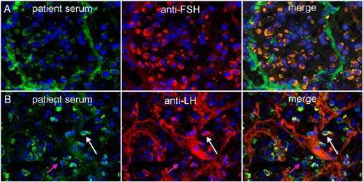 Recognition of gonadotropin-secreting cells by pituitary antibodies.