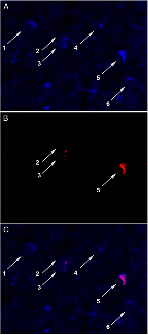 Monohormonal and bihormonal production by the gonadotrophs.