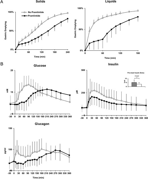 A, Gastric emptying for solids and liquids during triple tracer studies without pramlintide (dashed-open circle) and with pramlintide (solid-closed square) in subjects with type 1 diabetes (T50 gastric emptying for liquids and solids emptying was delayed with pramlintide, P < .001). B, Plasma glucose, insulin, and glucagon concentrations during triple tracer meal studies without pramlintide (dashed-open circle) and with pramlintide (solid-closed square) in subjects with type 1 diabetes. Error bars represent SD.
