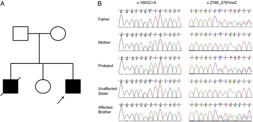 SLC12A1 mutations with Sanger sequencing in neonatal primary hyperparathyroidism patients.