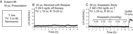 One male subject with reversal and relapse of hypogonadotropic hypogonadism.